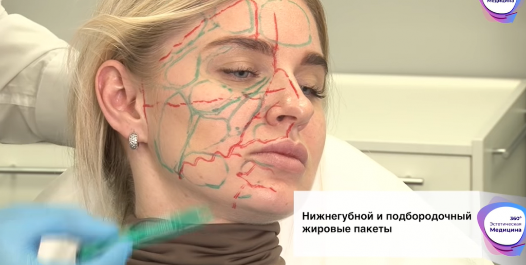 anatomy.png