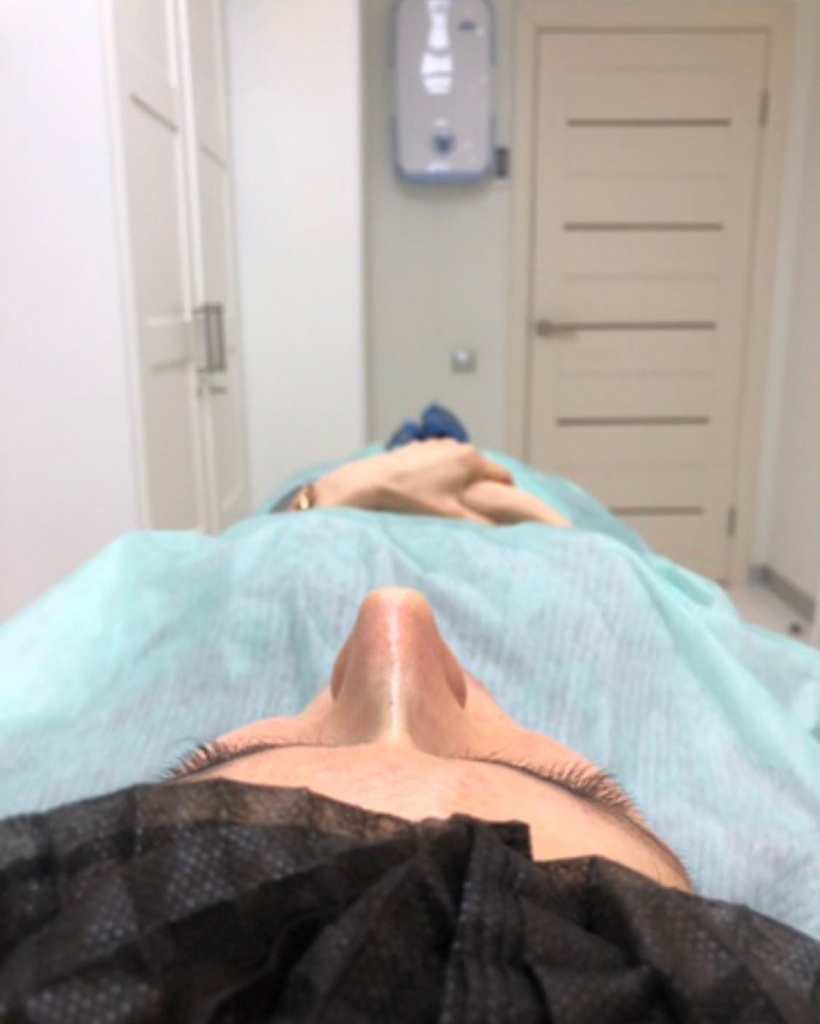 rinoplastia-photo.jpg