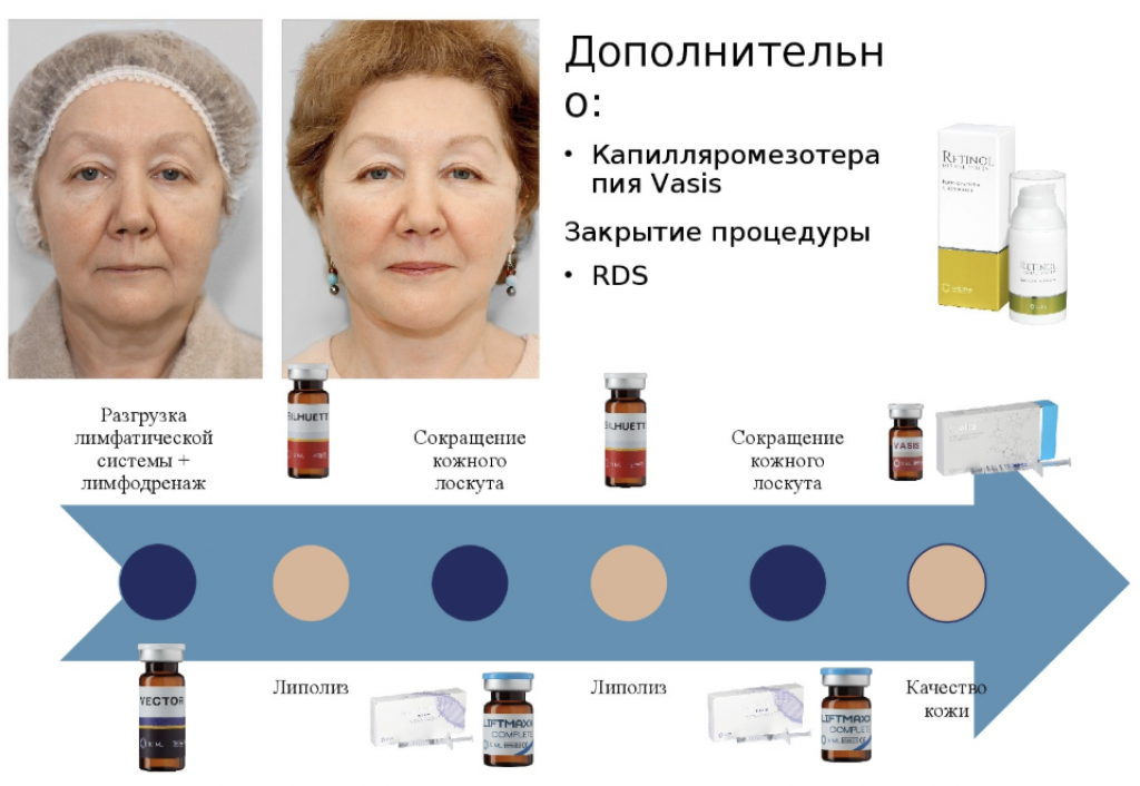 Снимок экрана 2020-06-10 в 13.36.00.png