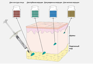 Tesoro DEEP (Тесоро Дип) фото: купить в Москве в интернет-магазине Filleronline.ru