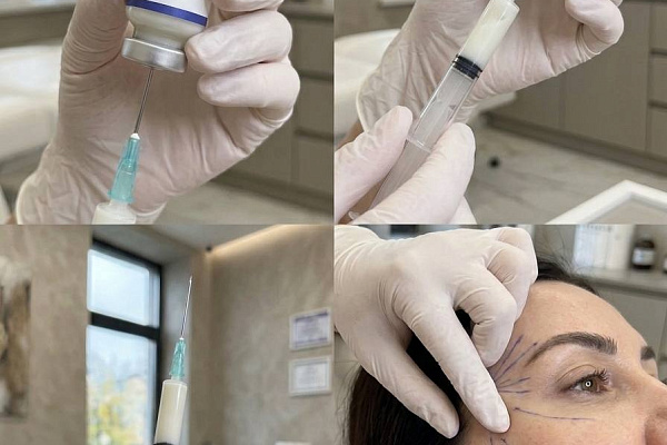 Фото Сиалис и Антиэйдж в Эстетической Медицине  В косметологии | FillerOnline.ru